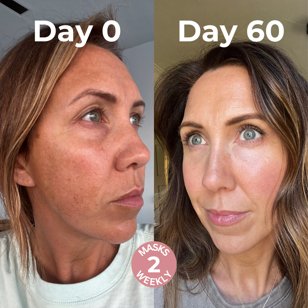 Mascarilla de biocolágeno