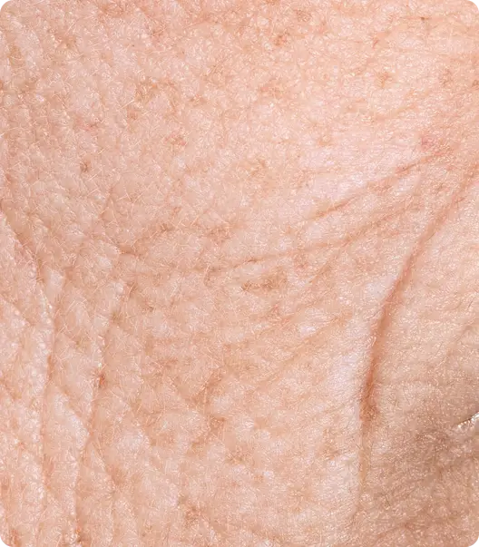 Primer plano de piel con líneas finas y arrugas