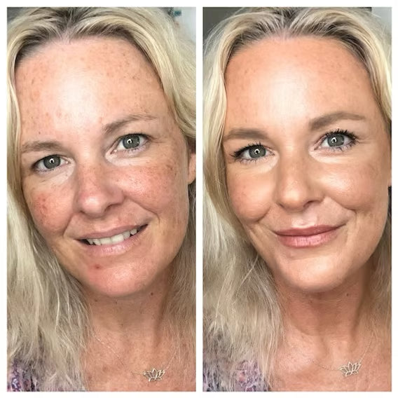 Before/after showing professional rejuvenation