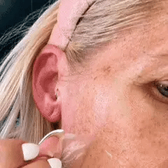 Before/after showing texture transformation - rough, dry patches to smooth, even skin