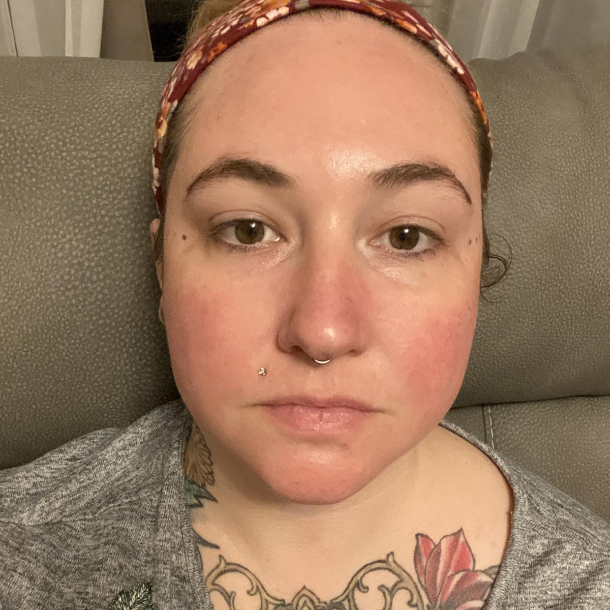 Sensitive Skin