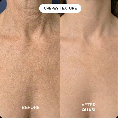 Collagen Chest Mask