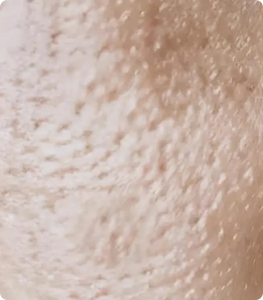 Sagging, Large Pores