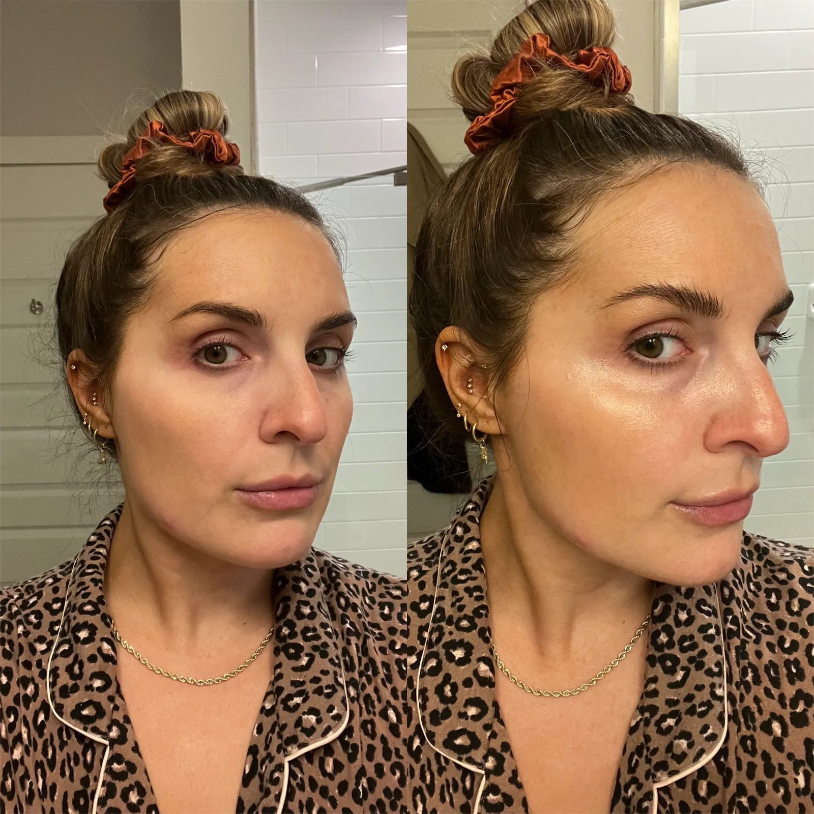 Antes e Depois