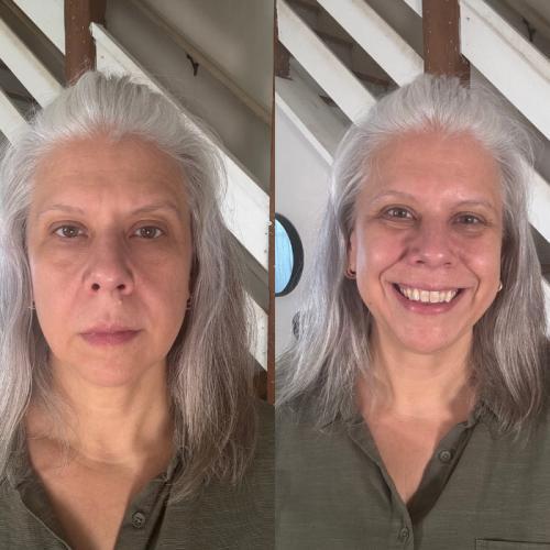 Carol, before and after