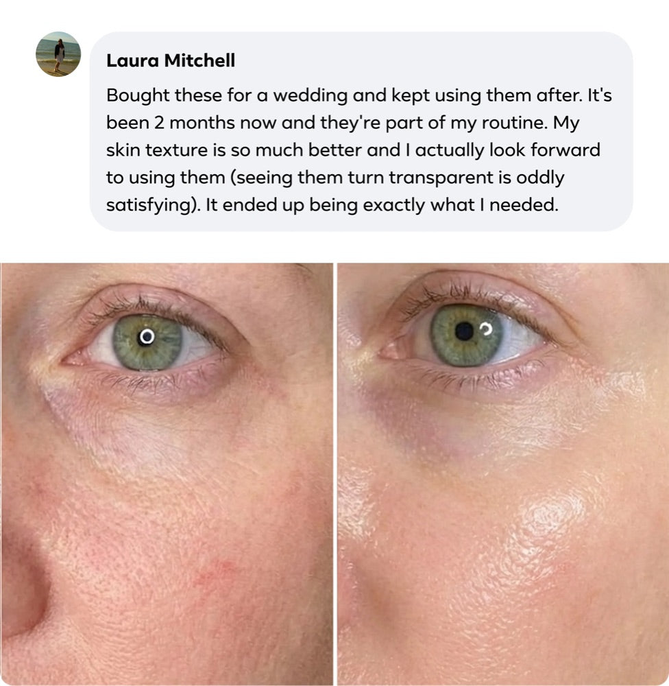 Laura Mitchell's review with her before and after photos