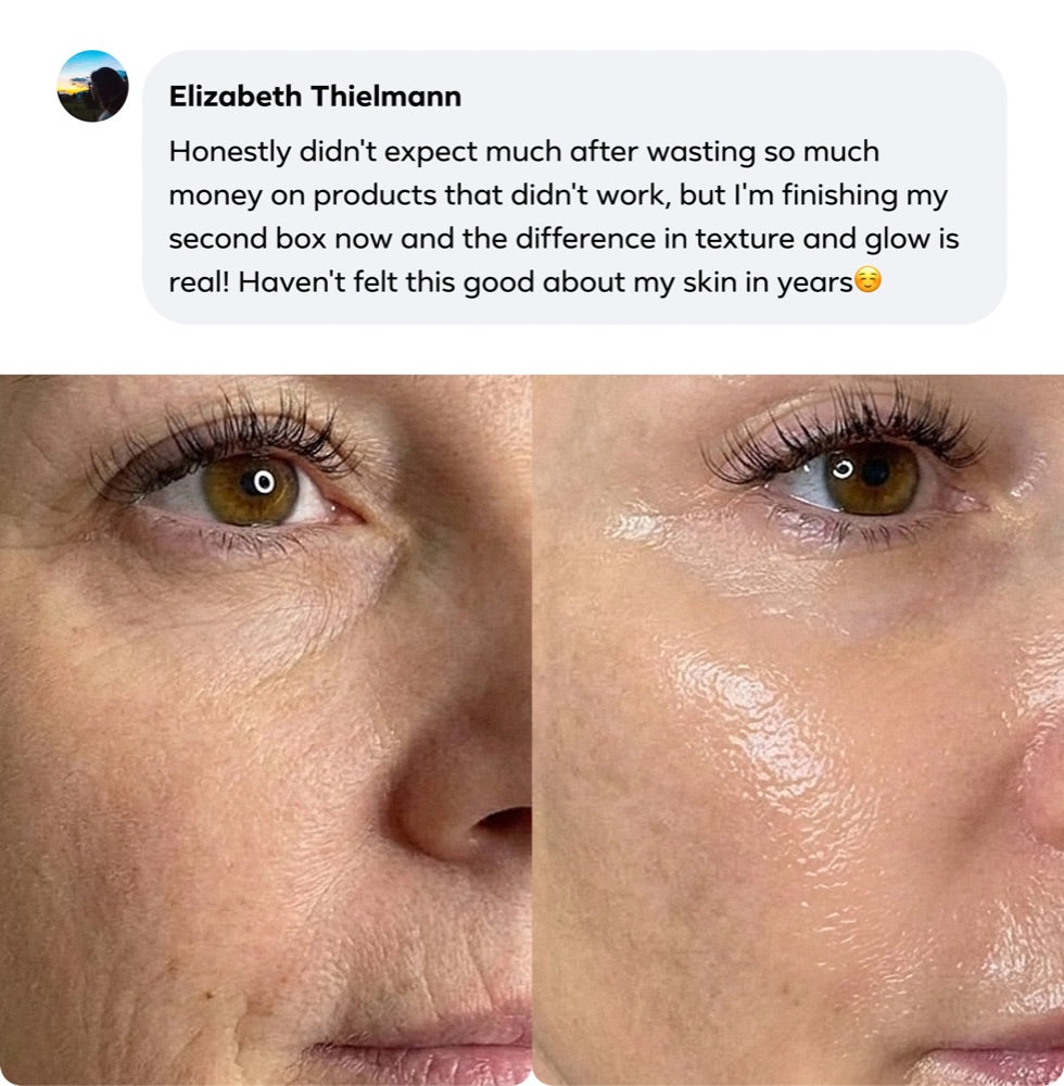 Elizabeth Thielmann's review with her before and after photos