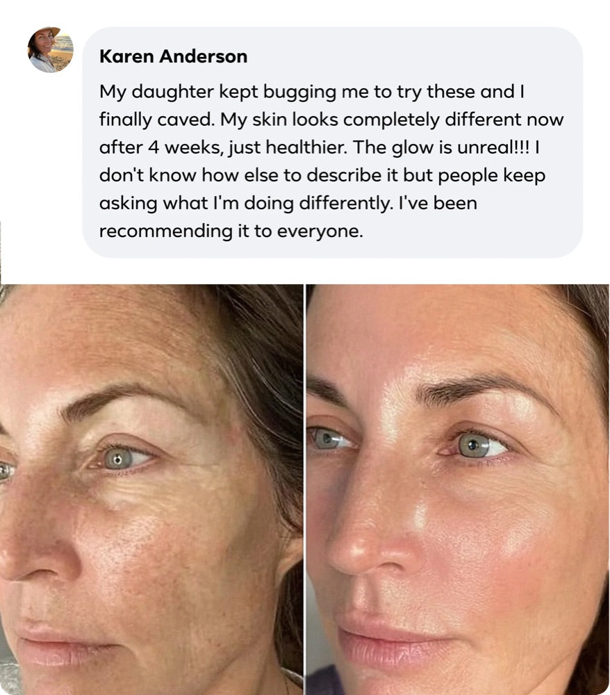 Karen Anderson's review with her before and after photos
