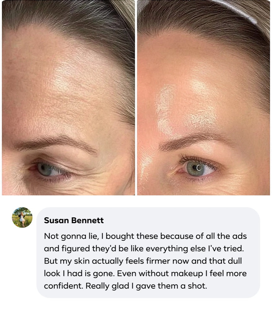 Susan Bennett's review with her before and after photos